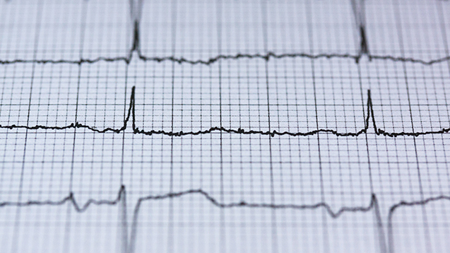 Heartbeat - medical, health